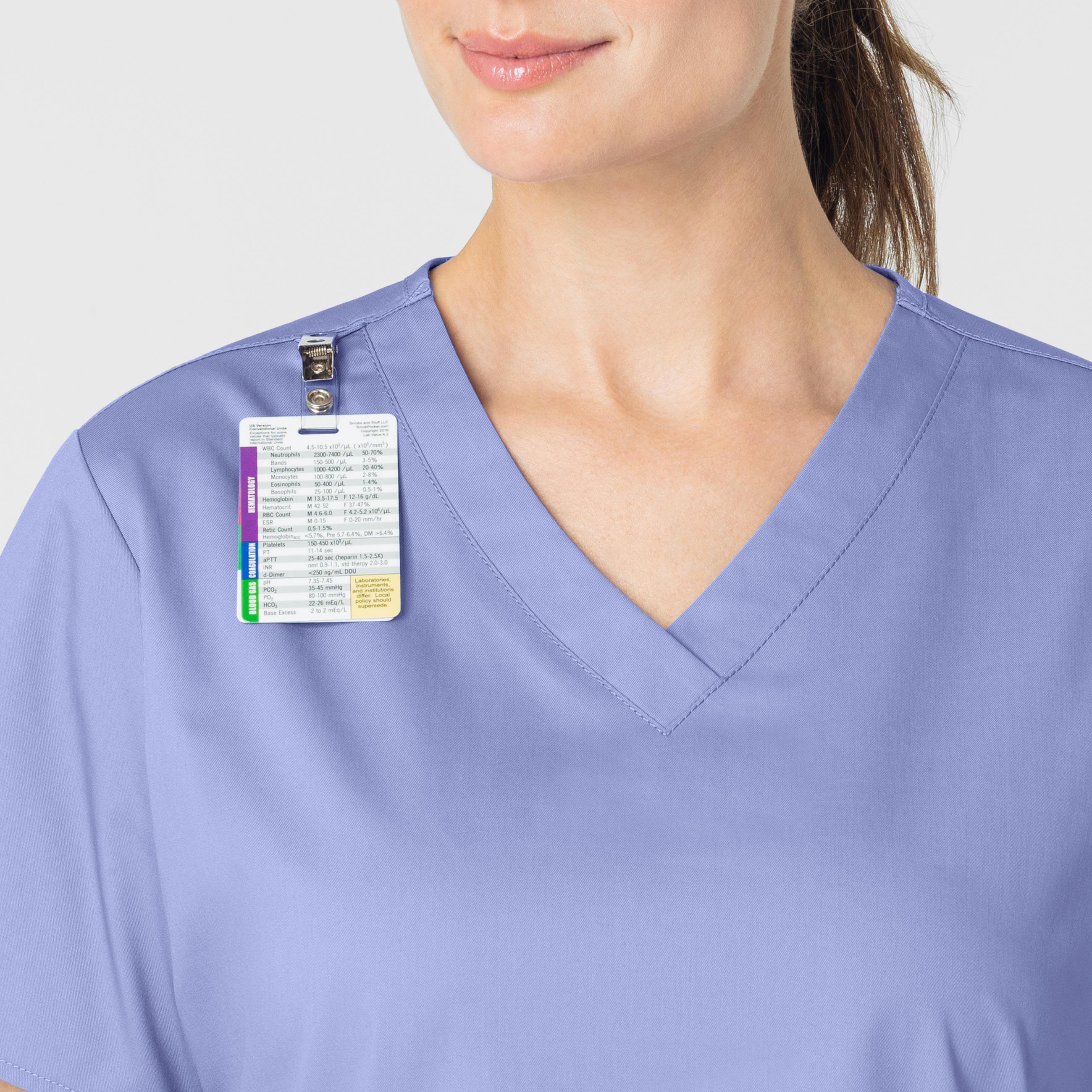 WonderWORK 101 V-Neck Scrub Top Ceil Blue